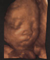 3D image of baby's face